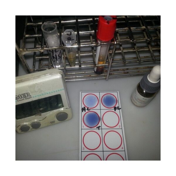 Brucella Agglutination Test