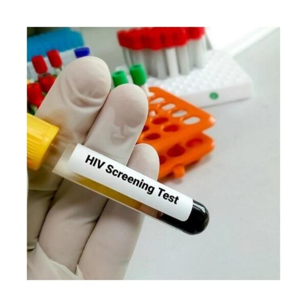 HIV Screening Test