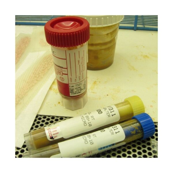 Stool Analysis